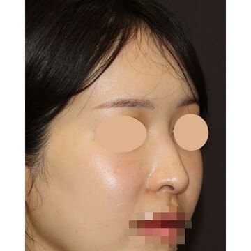 聖心美容クリニックの症例写真[アフター]