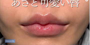 PRISM Beauty Clinicの症例写真[アフター]