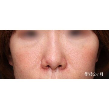 聖心美容クリニックの症例写真[アフター]