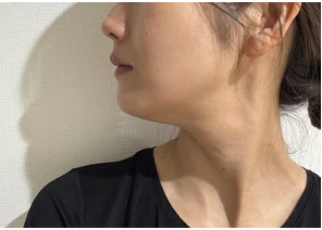ペルラクリニック神宮前の症例写真[アフター]