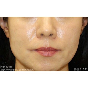 聖心美容クリニックの症例写真[アフター]