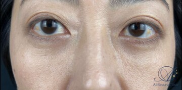 AI Beauty Clinicの症例写真[アフター]