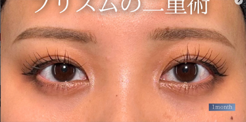 PRISM Beauty Clinicの症例写真[アフター]