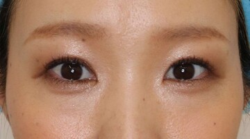 すなおクリニックの症例写真[アフター]