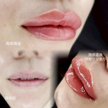 医療法人美戸会　かなえデンタルクリニックのアートメイクの症例写真