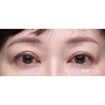 聖心美容クリニックの症例写真[アフター]