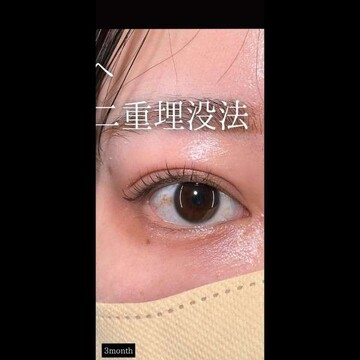 PRISM Beauty Clinicの症例写真[アフター]