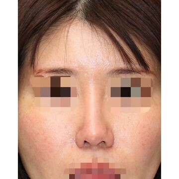 聖心美容クリニックの症例写真[アフター]