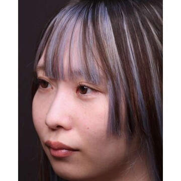 聖心美容クリニックの症例写真[アフター]