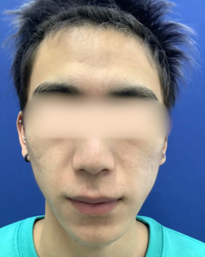 フェミークリニックの症例写真[アフター]
