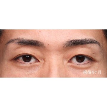 聖心美容クリニックの症例写真[アフター]