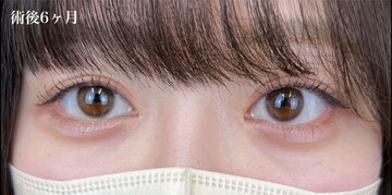 AI Beauty Clinicの症例写真[アフター]