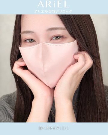 アリエル美容クリニック 横浜院の目・二重整形の症例写真