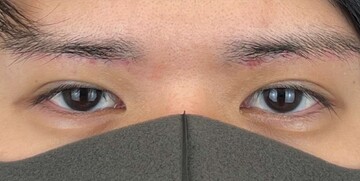 AI Beauty Clinicの症例写真[アフター]