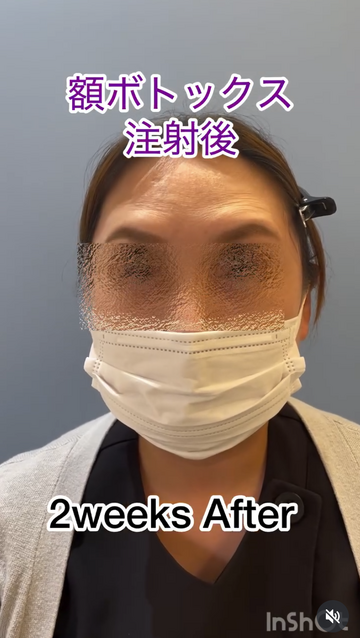 みやもと美容クリニックの症例写真[アフター]
