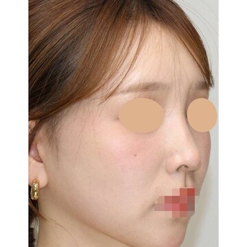聖心美容クリニックの症例写真[アフター]