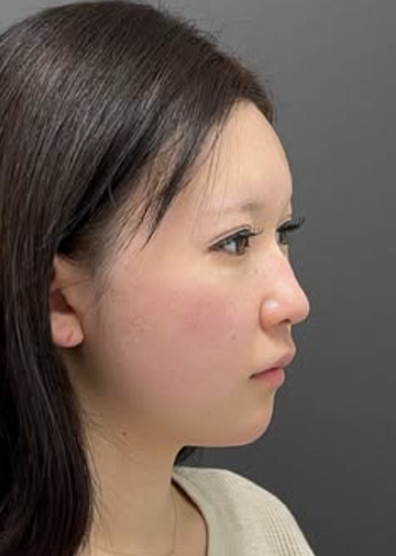 Plume Clinicの症例写真[アフター]