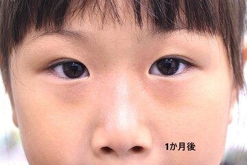医療法人秀晄会 心斎橋コムロ美容外科クリニックの症例写真[アフター]