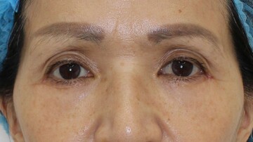 すなおクリニックの症例写真[アフター]