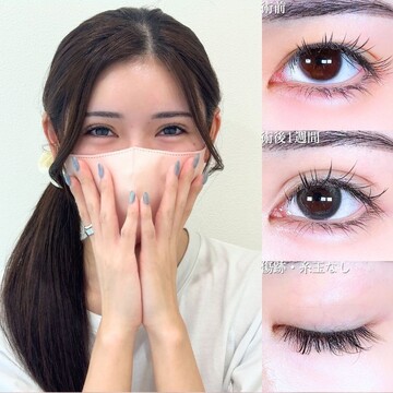アリエル美容クリニック 大宮院の二重の症例写真