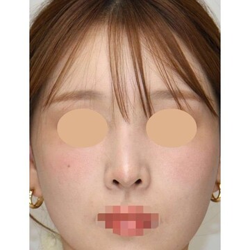 聖心美容クリニックの症例写真[アフター]