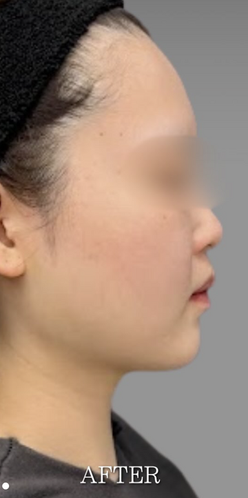 Plume Clinicの症例写真[アフター]