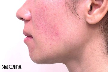 医療法人秀晄会 心斎橋コムロ美容外科クリニックの症例写真[アフター]