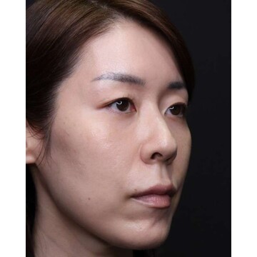 聖心美容クリニックの症例写真[アフター]