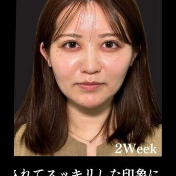 PRISM Beauty Clinicの症例写真[アフター]