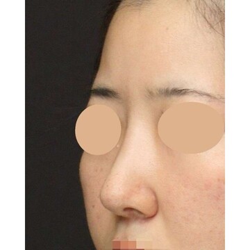 聖心美容クリニックの症例写真[アフター]