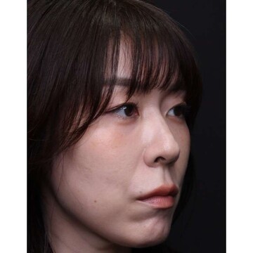 聖心美容クリニックの症例写真[アフター]