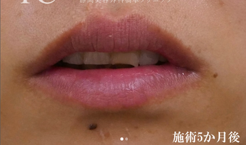 静岡美容外科橋本クリニックの症例写真[アフター]