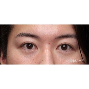 聖心美容クリニックの症例写真[アフター]