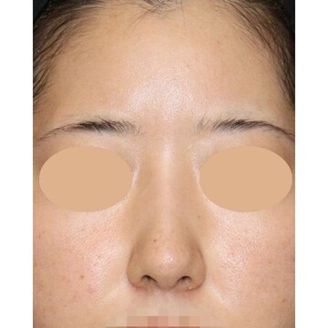 聖心美容クリニックの症例写真[アフター]