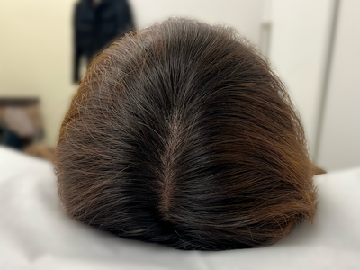ヘアアートメイク｜40代｜2回の症例写真[ビフォー]