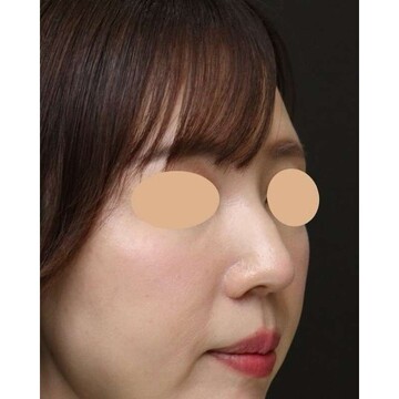 聖心美容クリニックの症例写真[アフター]