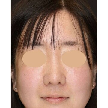 聖心美容クリニックの症例写真[アフター]