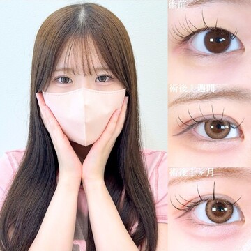 アリエル美容クリニック 大宮院の二重の症例写真