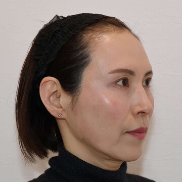 すなおクリニックの症例写真[アフター]