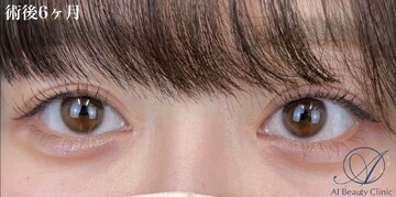 AI Beauty Clinicの症例写真[アフター]