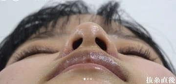 静岡美容外科橋本クリニックの症例写真[アフター]