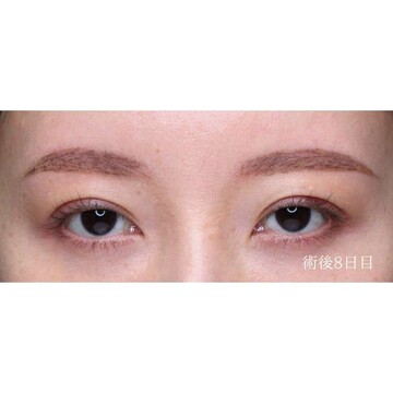 聖心美容クリニックの症例写真[アフター]