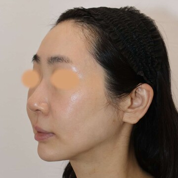 すなおクリニックの症例写真[アフター]