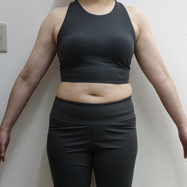 [50代 女性] 【医療痩身のダイエットプログラム ノントレ】（痩身、メディカルダイエット）の症例写真 (CS73692)｜グランジ ...