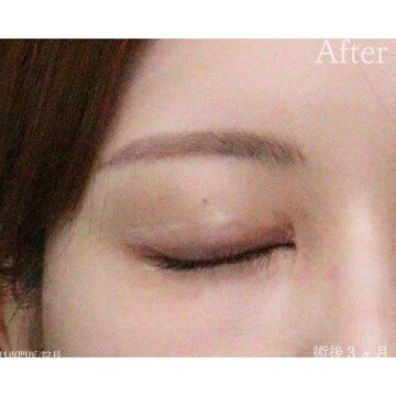 聖心美容クリニックの症例写真[アフター]