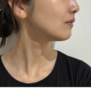 ペルラクリニック神宮前の症例写真[アフター]