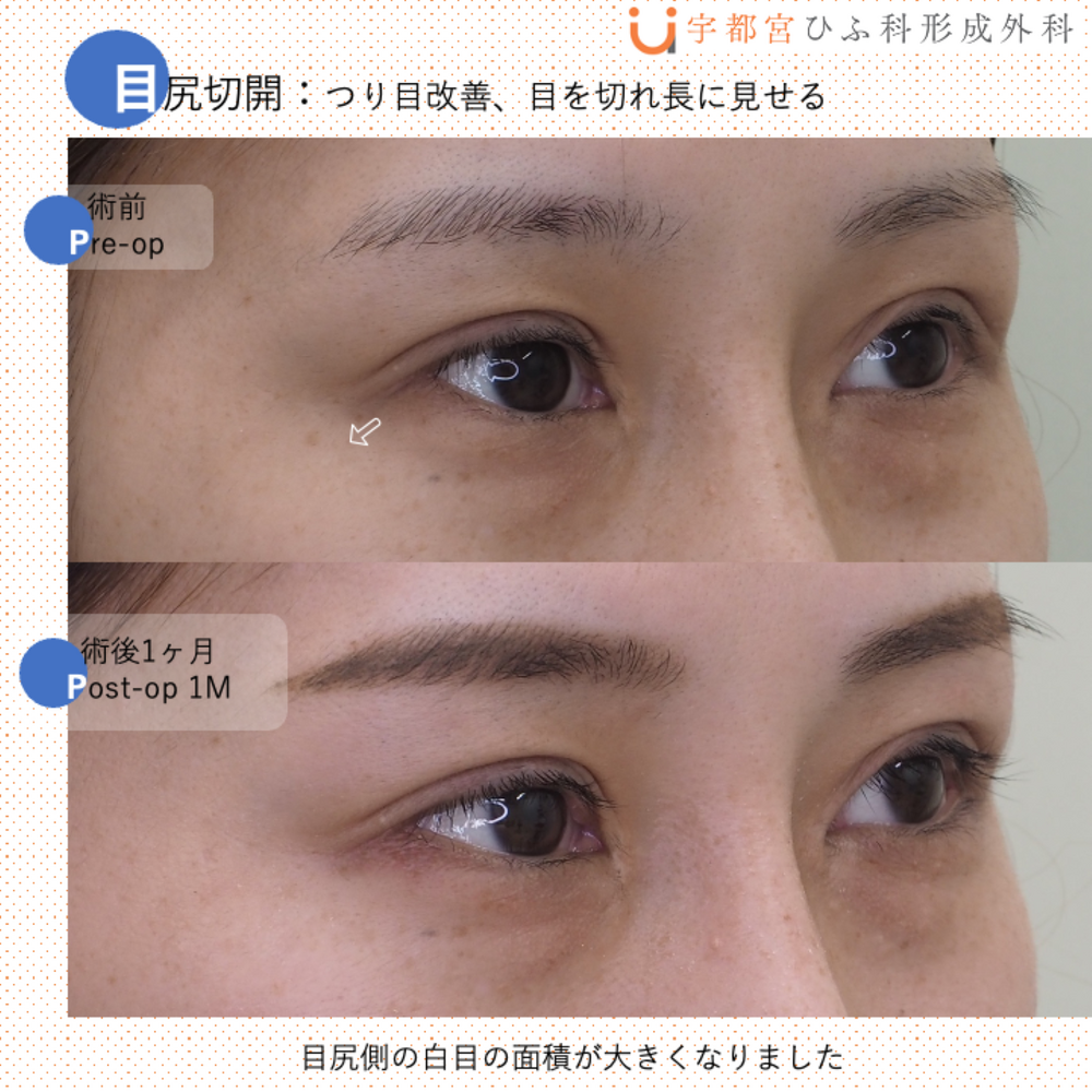 切れ長 の 目 に なるには | 目 切れ長 基準 – XYFNJ