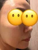 ペルラクリニック神宮前の症例写真[アフター]