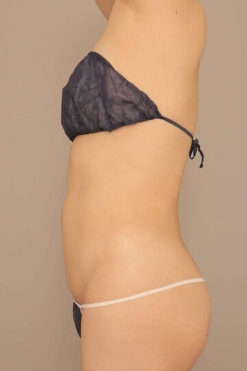 Mods Clinic (モッズクリニック)の症例写真[アフター]