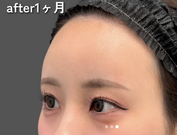 Plume Clinicの症例写真[アフター]